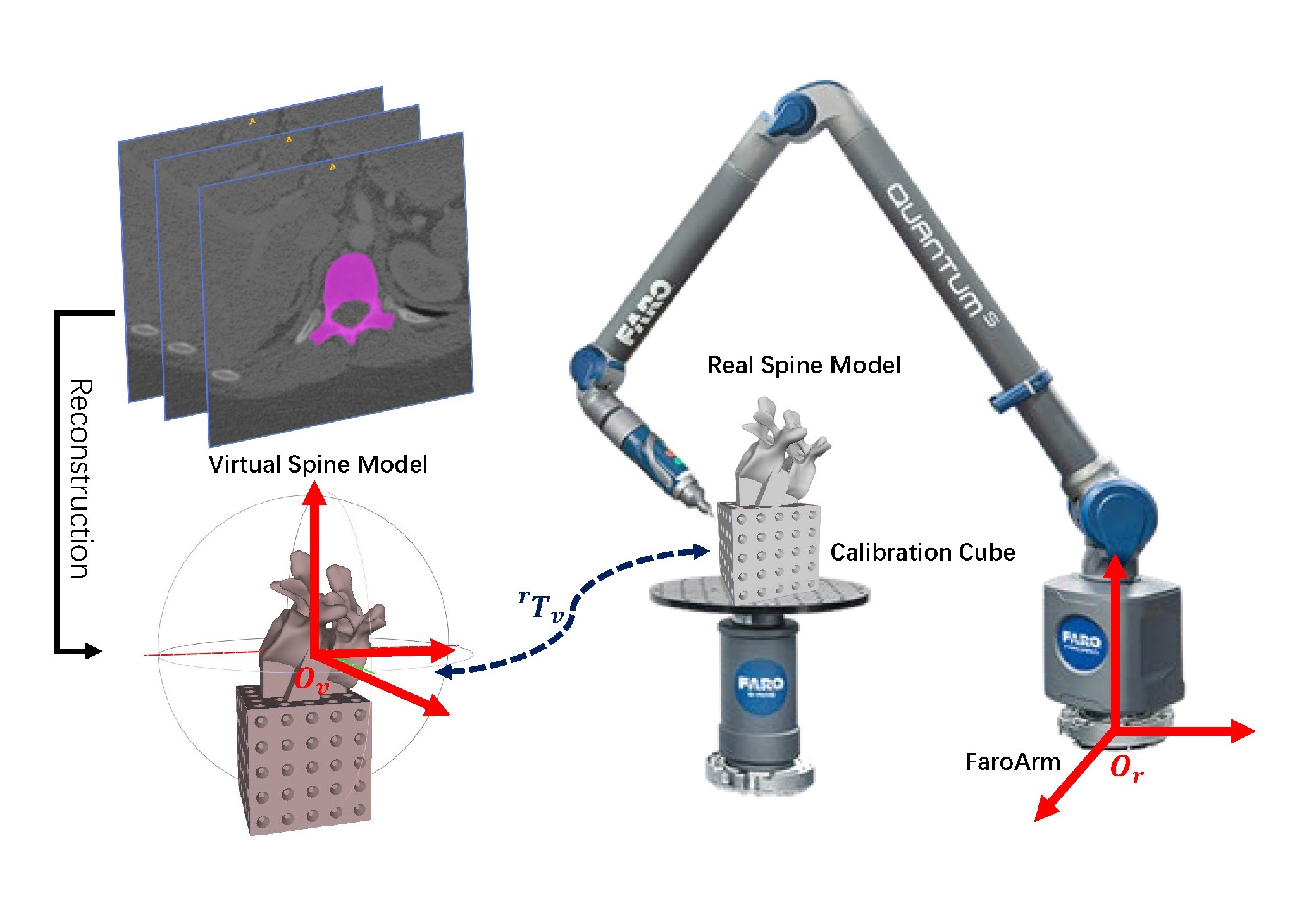 Accuracy Assessment of CT-based Spine Bone
Reconstruction using *FaroArm*