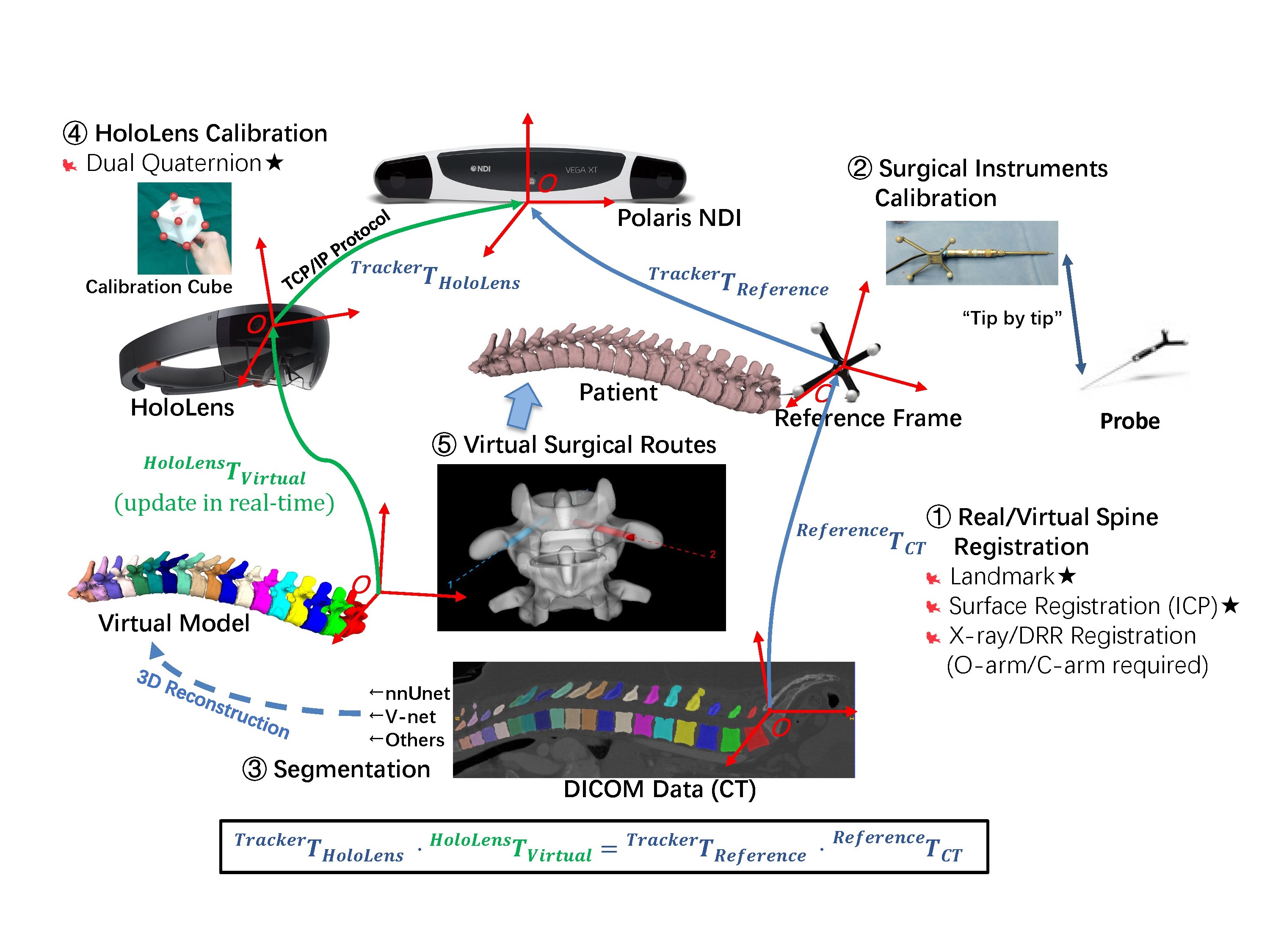 Framework of AR based Spine Surgical Navigation System