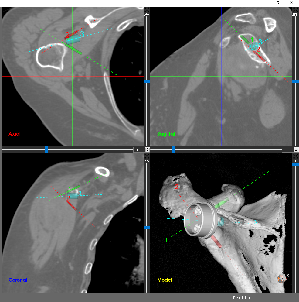 RTSA Surgical Navigation Software