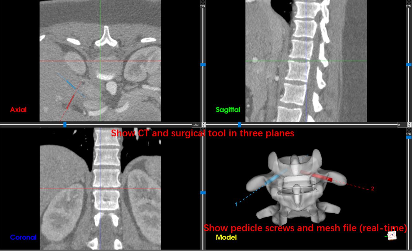 AR-based Surgical Navigation Software